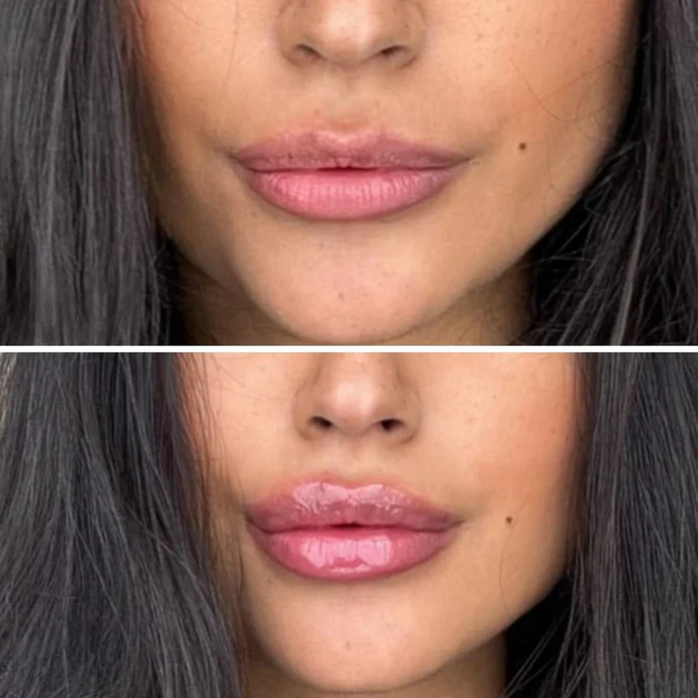 Extreme Lip Plumper